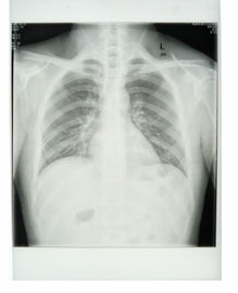 Gewohnheit 25cm * 30cm Weiß-Basis-Röntgenstrahl-Papier-medizinischer Film mit HAUSTIER-Materialien